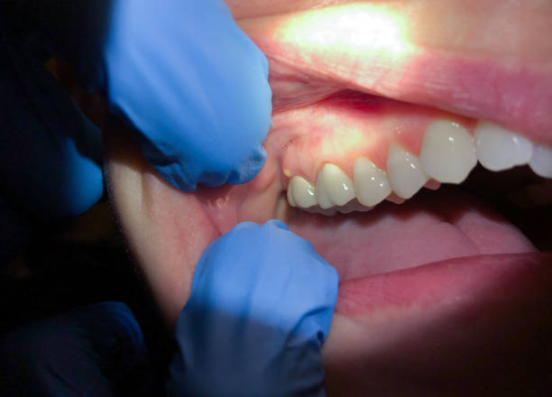 Best Pediatric Emergency Dentist in North Fork, CA